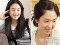 明星整容前后照片，明星整容前后照片图片