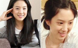 明星整容前后照片，明星整容前后照片图片